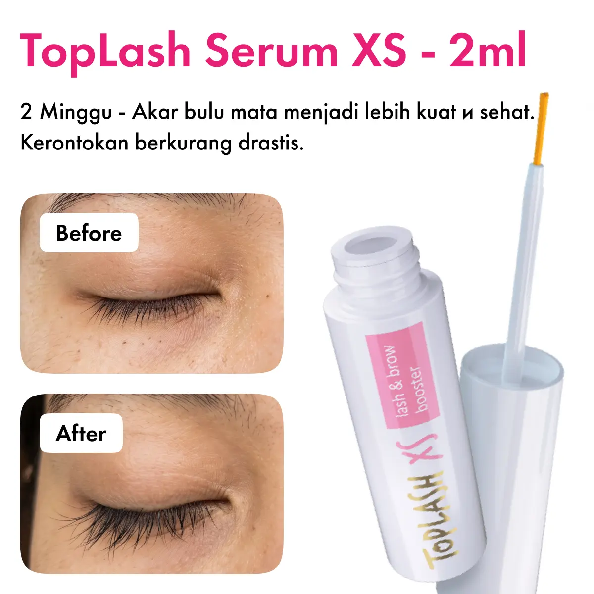 XS 2ml - 2 Minggu