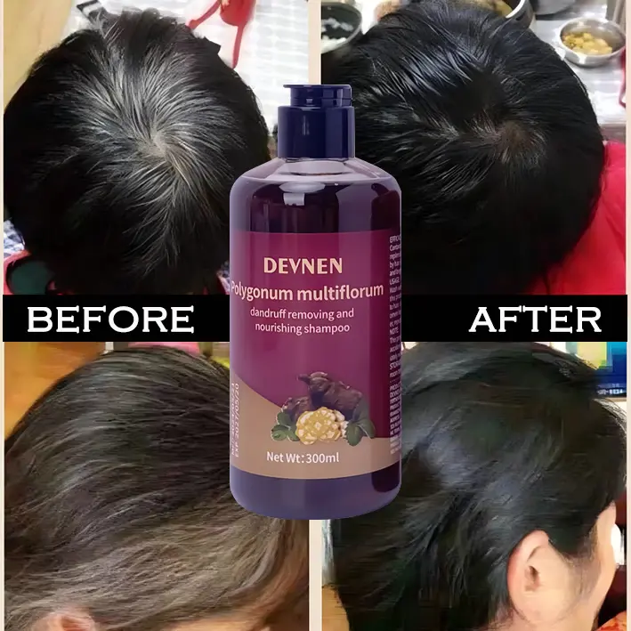 SHAMPO Black Herbal Natural Penyamar Rambut dan Penghiang uban Usia Muda 300ml Shampoo Herbal Polygonum Penghitam Rambut Hitam Dalam Sampo Ketombe Sampo Menghitamkan  Conditioner 6
