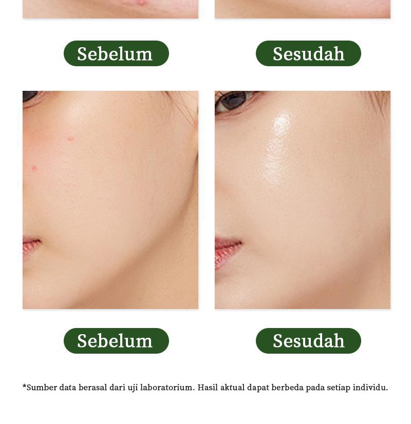 【Pengiriman Privasi】Meet Face Gel Pengelupasan Ekstrak Herba 50g Melembapkan & Menyuburkan Kulit Kusam Cocok untuk Wanita Berminyak Perawatan Wajah Harian