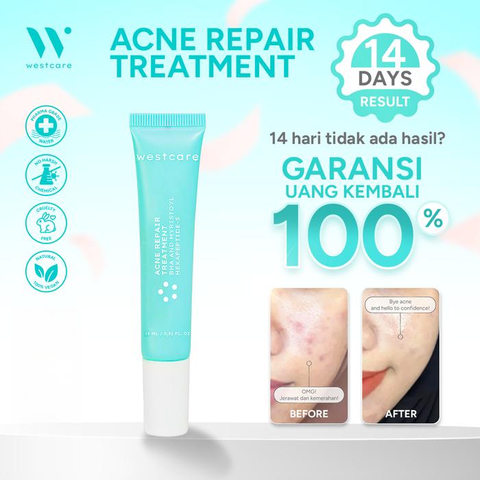 Gambar Westcare Acne Repair Treatment 15ml - 14 Days Money Back Guarantee - 15ml dari Westcare Skincare Kab. Tangerang Tokopedia