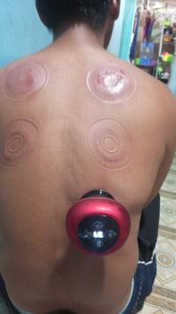 Product Review of Alat Bekam Elektrik Pintar / Alat Penghilang Cape Pegal from 💫**a u**💫 0