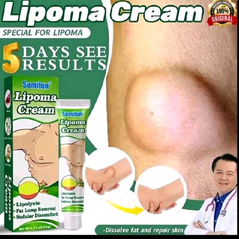 Lipoma Cream Obat Benjolan Lipoma Krim Benjolan Di Leher Tangan Ketiak Benjolan Di Leher Punggung Pundak Kaki Selangkangan Telinga 0