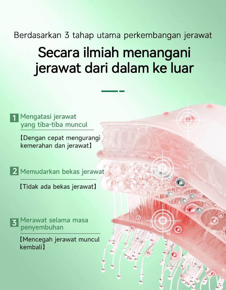 Product Introduction of （T1）BPOM.Beli 2 Gratis 1.Challenge 7 Hari Jerawat Hilang,CINSULIN Obat Jerawat Herbal Ekstrak Alami Cepat Hilangkan Komedo & Jerawat Meradang  BPOM Certified  Aman untuk Remaja & Kulit Sensitif Berjerawat Wajah Gatal Beruntusan 3