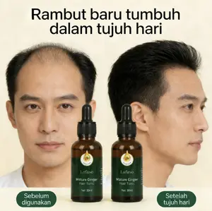【Bisa COD】Efektif dalam 7 hari! Serum penumbuh rambut termurah! Penawaran promosi terbaik, essence penumbuh rambut dan anti rambut rontok.