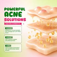 Gambar 【HEMAT】LUMIWHITE - Paket Acne Shield Series (FREE 1 SACHET RANDOM+CLOUD PADS) dari LUMIWHITE Kota Administrasi Jakarta Pusat 5 Tokopedia