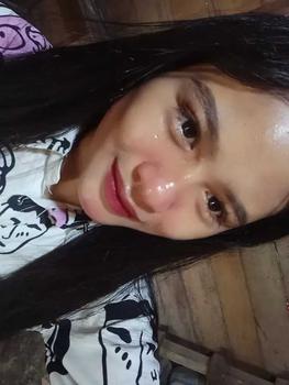 Product Review of [opy] DOSIS 2 - Paket Retinol Booster Cysteamine / Antioxidant from ** 2