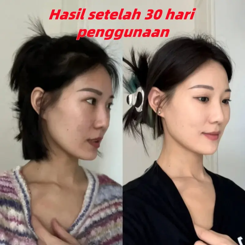 SC-II Pembersih Wajah Whitening. Kulit Halus dan Cerah, Skin&Cleaning Pembersih Wajah Niacinamide Pemutih, Dirancang Khusus untuk Kulit Kusam moisturizer  sensitif 5