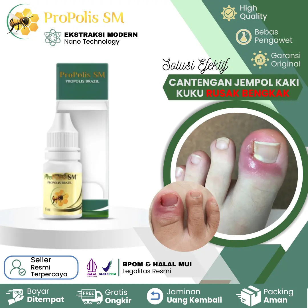 Herbal Cantengan Jempol Kaki Kuku Rusak Bengkak Bernanah Berdarah Kuku Jamuran Propolis SM Isi 6ML Herbal Alami