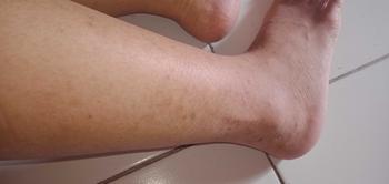 Product Review of ESASKIN (Paket) Peeling Spray dan Body Serum - Spesial Kulit Belang Mencerahkan Tubuh Serum Badan Kaki tangan from c**🦩 1