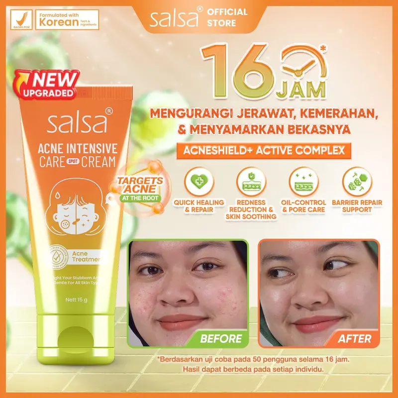 SALSA ACNE SPOT – obat jerawat salep jerawat ance gel anti acne cream | obat totol jerawat pustula papula bruntusan|acne treatment 0