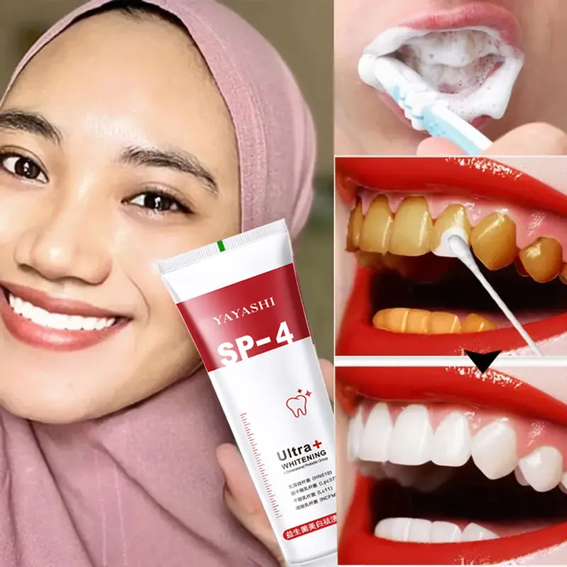 Whitening toothpaste Pasta gigi pemutih gigi SP-4 pasta gigi pasta gigi probiotik pemutih gigi pemutih gigi dan penghilang karang gigi niacinamide nenghilangkan noda dari karang gigi kuning pasta gigi Mulut Memutihkan