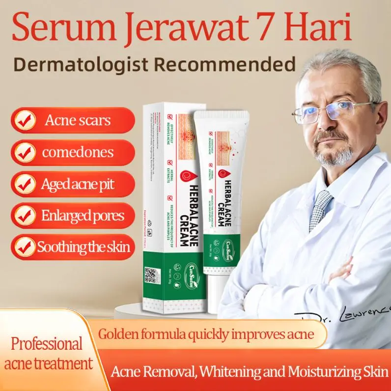（T2）BPOM.Beli 2 Gratis 1.Challenge 7 Hari Jerawat Hilang,CINSULIN Obat Jerawat Herbal Ekstrak Alami Cepat Hilangkan Komedo & Jerawat Meradang  BPOM Certified  Aman untuk Remaja & Kulit Sensitif Gatal Beruntusan Wajah Berjerawat