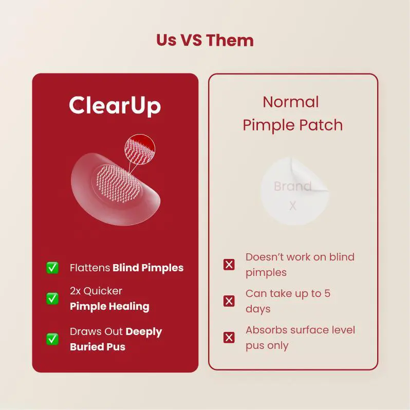 ClearUp Microdarts for Acne | Microneedle Patches for Blind Pimples |  Microdart Acne Patches | Pure Hydrocolloid Skincare Skin Repair