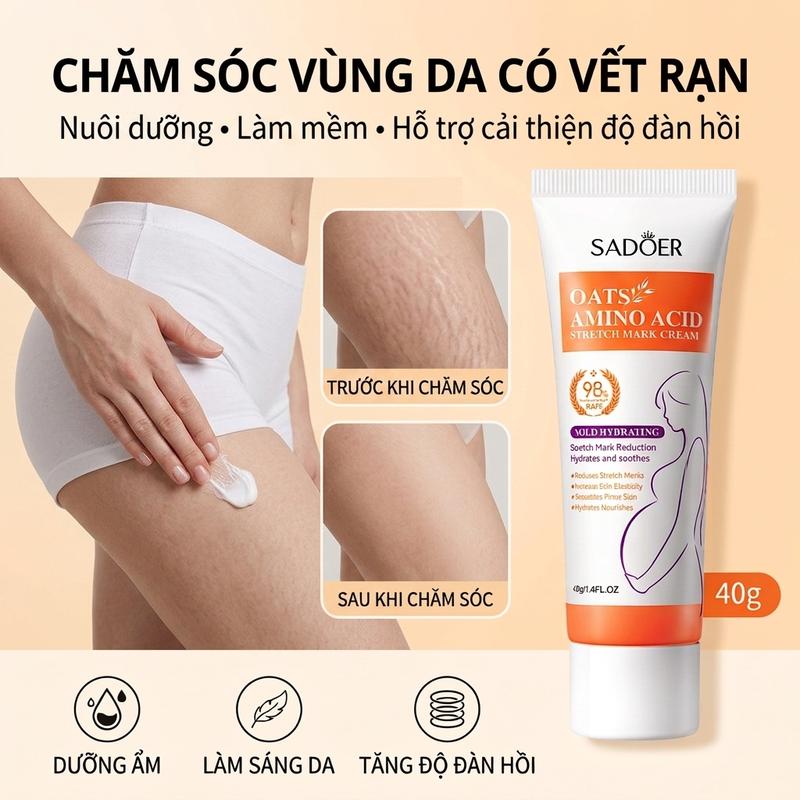 Kem Rạn Da 40g – Kem Bôi Rạn Da Sau Sinh, Rạn Bụng Rạn Đùi Rạn Mông, Rạn Đỏ Rạn…
