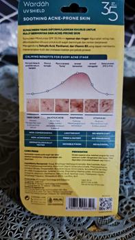 Product Review of [TWINPACK] WARDAH UV Shield Acne Calming Sunscreen - Skincare from A**r 1
