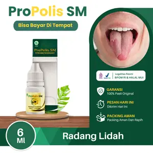 Propolis SM Untuk Radang Lidah Putih, Luka Pada Lidah, Lidah Mati Rasa, Lidah Meradang, Lidah Tidak Berasa