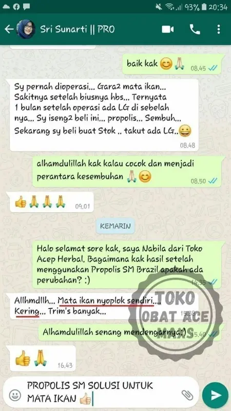 Obat Koreng Borok, Obat Koreng , Obat Koreng Di Kaki - PROPOLIS SM 3