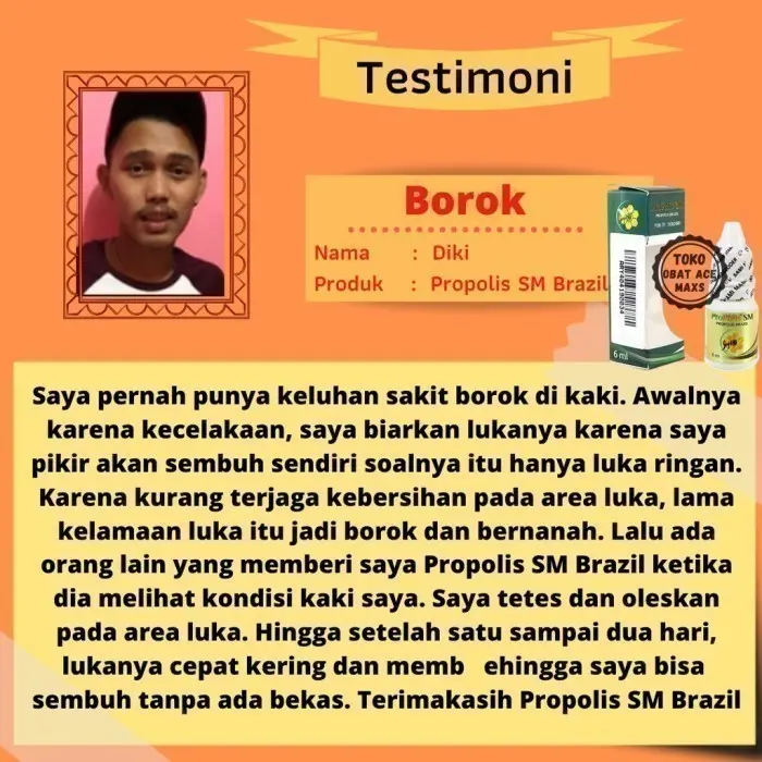 Obat Koreng Borok, Obat Koreng , Obat Koreng Di Kaki - PROPOLIS SM 2