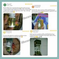 Gambar Obat Keloid Daging Tumbuh di Bekas Luka Operasi/Suntik - Propolis SM dari JOBA STORE Kota Tasikmalaya 2 Tokopedia