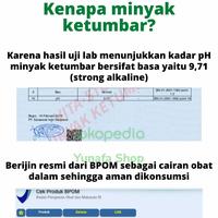 Gambar MINYAK KETUMBAR / HERBAL HIPERTENSI DAN KOLESTEROL dari Yunafa Shop Kota Administrasi Jakarta Pusat 4 Tokopedia
