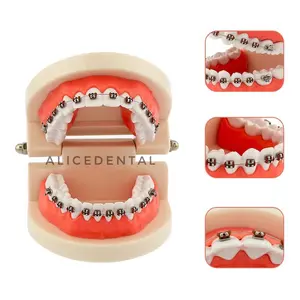 Alice dental model studi ortho study phantom gigi typodont orthodontic