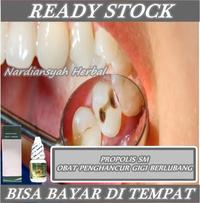 Gambar Obat Penghancur Gigi Berlubang, Nyeri Sering Nyut Nyutan, Pereda Sakit dari azqiaraherbal Kota Administrasi Jakarta Barat 1 Tokopedia