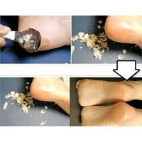 Gambar Alat Perawatan Pembersih Kulit Mati Kaki Pedicure Foot Care - Silver dari mesin rms Kab. Bogor 5 Tokopedia