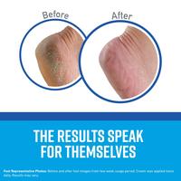 Gambar Krim Tumit O keeffe Healthy Feet Cream Kulit Kaki Kering & Pecah 91gr dari 21 scents. Kota Administrasi Jakarta Utara 4 Tokopedia