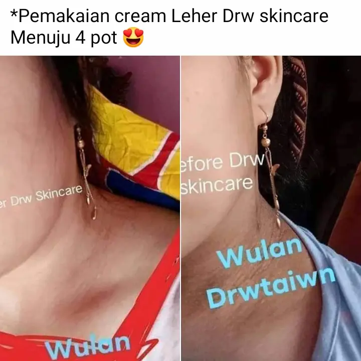 Brightening Neck Cream/Krim Pemutih Leher Drw Skincare. Terdaftar BPOM 2