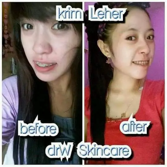 Brightening Neck Cream/Krim Pemutih Leher Drw Skincare. Terdaftar BPOM 3
