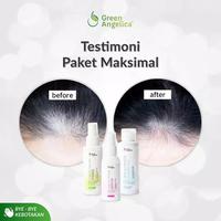 Gambar Green Angelica Paket Maximal Treatment - Penumbuh Rambut Botak Rontok dari Green Angelica Store Kota Surabaya 5 Tokopedia