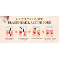 Gambar Oedo Pembersih Penghilang Facial Mask Komedo Wajah Hidung Hitam Ampuh dari League Shop_NEW Kota Medan 4 Tokopedia