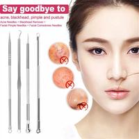 Gambar Alat Pencet Jerawat Komedo Set 4 In 1 Pinset Jerawat dari Ligalery Trend Kota Medan 2 Tokopedia