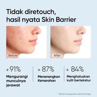 Gambar SKINTIFIC - 5x Ceramide Barrier Repair Moistur Gel Fullsize Shareinjar dari pumsbeauty Kab. Sukoharjo 2 Tokopedia