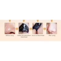 Gambar Oedo Pembersih Penghilang Facial Mask Komedo Wajah Hidung Hitam Ampuh dari League Shop_NEW Kota Medan 5 Tokopedia