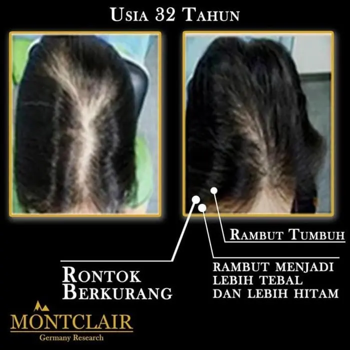 Montclair | Montclair Hair Serum | Penumbuh Rambut Monclair Grasse 4