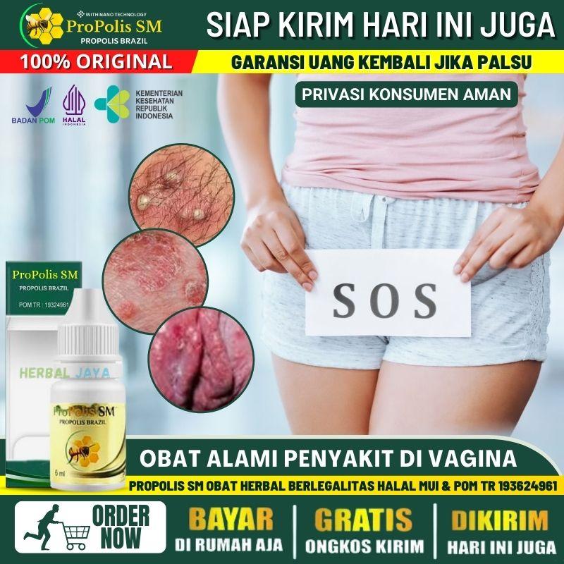 Obat Miss V Gatal, Gatal Infeksi Jamur, Gatal Keputihan - Propolis SM
