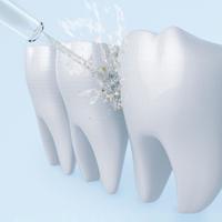 Gambar Mijia Electric Water Flosser 2 Oral Irrigator Dental Floss Pembersih Sela Gigi dari b2b mobile Kota Administrasi Jakarta Barat 3 Tokopedia