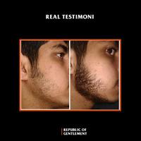 Gambar RANK BOOSTER BEARD OIL with REDENSYL by MASBREWS dari JOKULAND.ID Kota Tangerang 5 Tokopedia