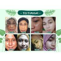 Gambar PAKET GLOWING SKINCARE PEMUTIH WAJAH AMPUH KRIM PENCERAH dari Reglow by Shindy Putri Shop Kota Administrasi Jakarta Barat 5 Tokopedia
