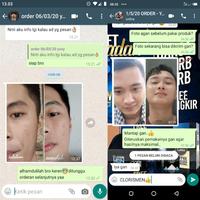 Gambar SABUN MUKA PRIA CLORISMEN Dry & Oily Skin Recomended Facial Wash Foam dari Gaza Racing Team Kota Bandung 5 Tokopedia