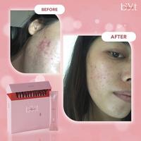 Gambar BYT COLLA 2 Sachet - Collagen Tripeptide Mencerahkan Kulit 2.8x Lebih Cepat Diserap, Halal & BPOM dari BYT Kab. Tangerang 4 Tokopedia