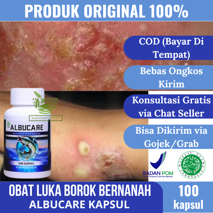 Gambar Obat Pengering Luka Borok Bernanah Gatal Berair/Budug/Gudik - ALBUCARE dari JOBA STORE Kota Tasikmalaya Tokopedia