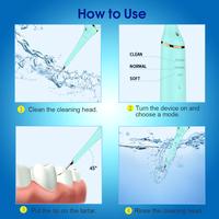 Gambar Pembersih Karang Gigi Plak Elektrik Baterai Charging 250 mAh 3 head dari KS & MayO Market Station Kota Administrasi Jakarta Barat 3 Tokopedia