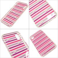 Gambar KS iphone case untuk iphone XS / X WIRU1249 - lips with stripe dari Neaka Store Kab. Brebes 5 Tokopedia