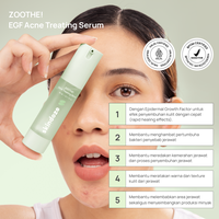 Gambar SKINDOZE Zoothe Acne Treating Serum dari Skindoze Kota Administrasi Jakarta Barat 4 Tokopedia