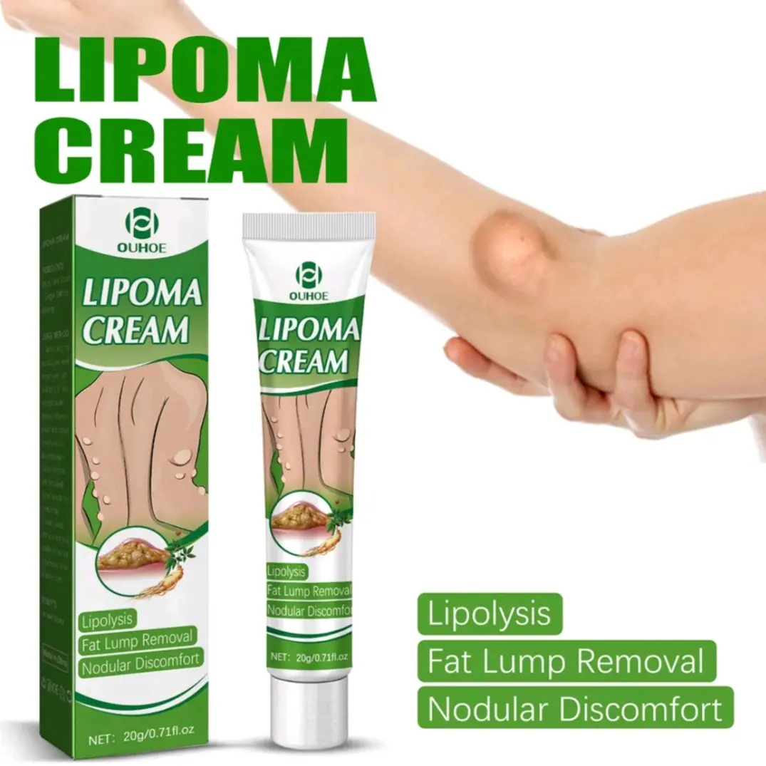 Krim Lipoma Krem Lipoma Salep Penghilang Lemak Tubuh Perawatan Tubuh