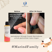 Gambar Minyak Gosok 20 ml - MARINDCARE- MEREDAKAN LUKA, SAKIT PINGGANG dari MarindcareOfficial Kota Surabaya 3 Tokopedia