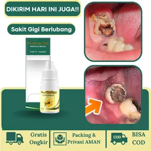 ProPolis SM Gigi Berlubang, Perontok Gigi Bolong, Sakit gigi Ngilu