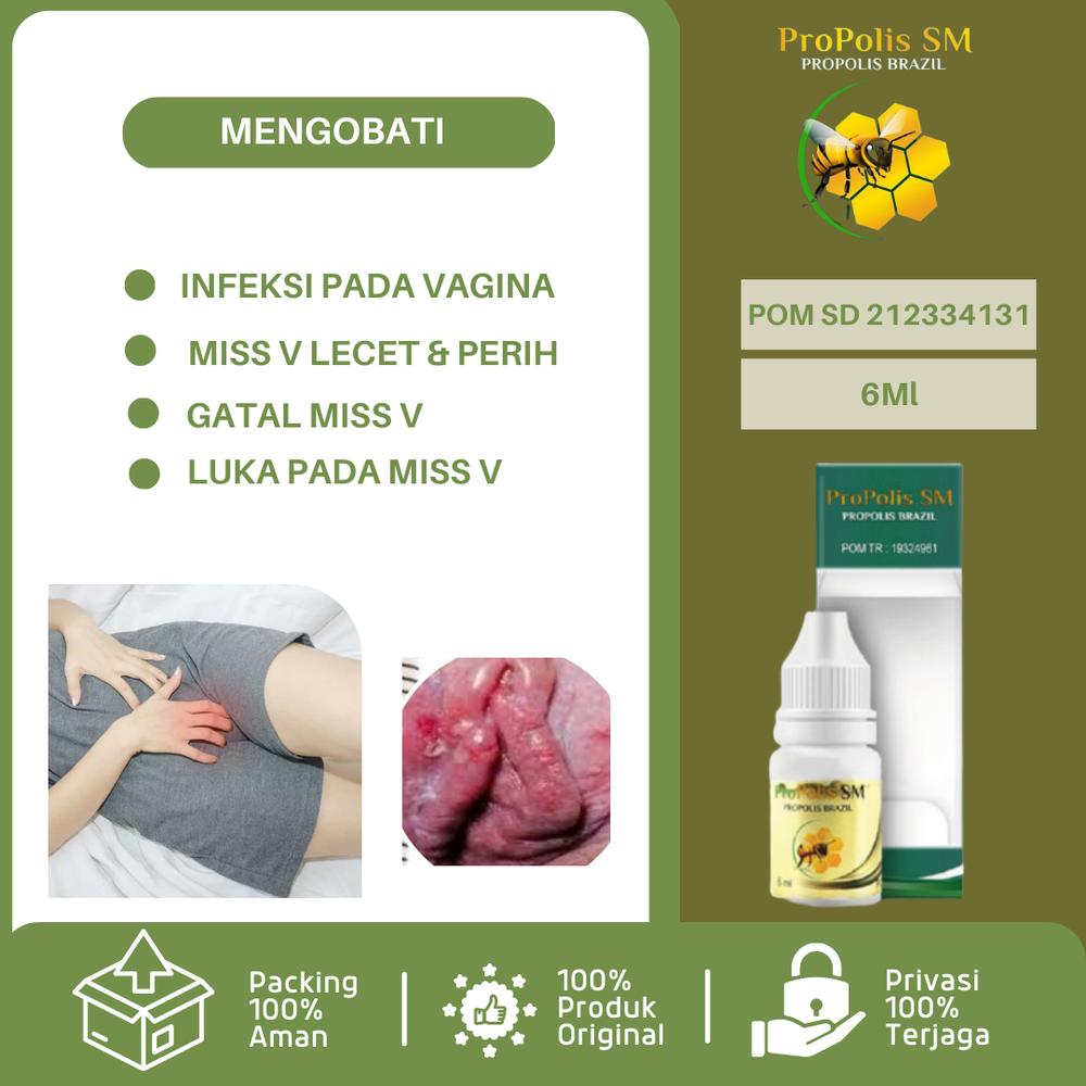 Obat Miss V Lecet, Obat Miss V Gatal, Perih, Bau, Lecet Bekas Pembalut